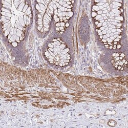 YAP1 Antibody, Novus Biologicals 0.1mL; Unlabeled:Antibodies, Polyclonal